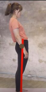 骨盆前移